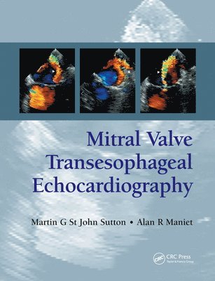 Martin G. St. John Sutton, Alan R. Maniet - Mitral Valve Transesophageal Echocardiography, Inbunden