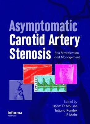 Issam D. Moussa, Tatjana Rundek, JP Mohr - Asymptomatic Carotid Artery Stenosis, Inbunden