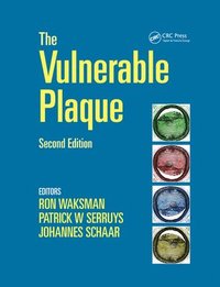bokomslag Handbook of the Vulnerable Plaque