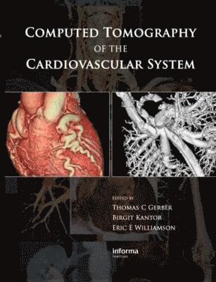Computed Tomography of the Cardiovascular System 1