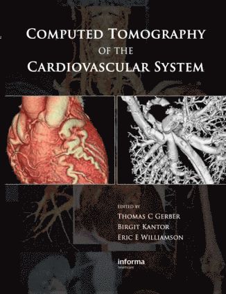 Computed Tomography of the Cardiovascular System