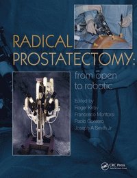 bokomslag Radical Prostatectomy