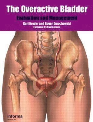 Karl Kreder, Roger Dmochowski - Overactive Bladder, Inbunden