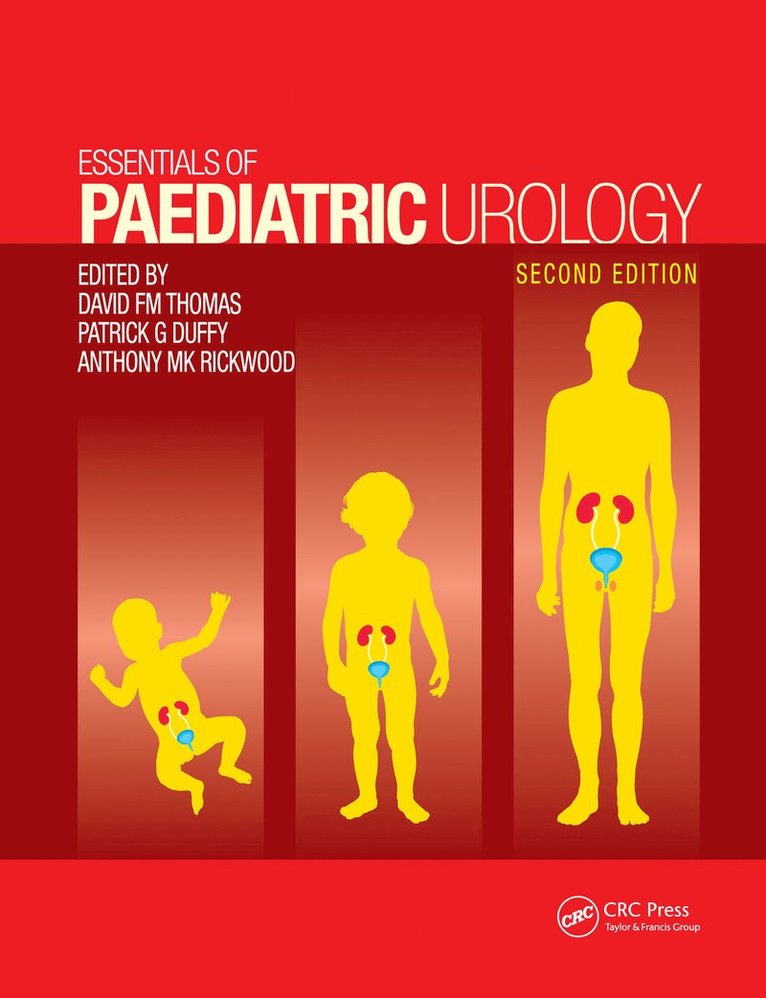 Essentials of Paediatric Urology