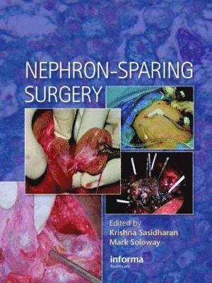 bokomslag Nephron-Sparing Surgery