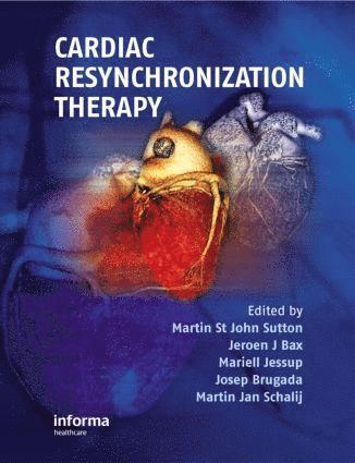 Martin St. John Sutton, Jeroen Bax, Mariell Jessup, Josep Brugada, Martin Schalij, Martin St John Sutton - Cardiac Resynchronization Therapy, Inbunden
