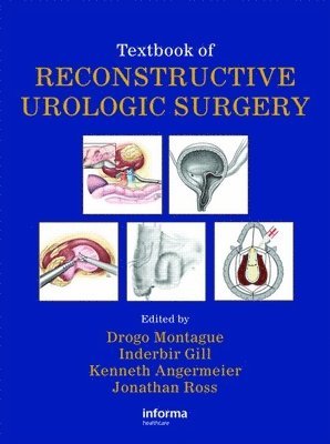 Textbook of Reconstructive Urologic Surgery 1