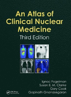 bokomslag Atlas of Clinical Nuclear Medicine