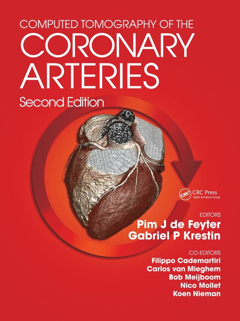 Pim J. de Feyter, G. P. Gabriel Krestin - Computed Tomography of the Coronary Arteries, Inbunden