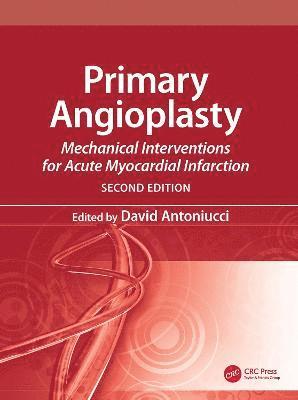 Primary Angioplasty 1