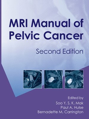 Soo Mak, Paul A. Hulse, B. M. Carrington, UK) Hulse, Paul A. (Consultant Radiologist, Christie NHS Foundation Trust, Manchester, UK) Carrington, B. M. (Consultant Oncoradiologist, Christie NHS Foundation Trust, Manchester - MRI Manual of Pelvic Cancer,Second Edition, Inbunden