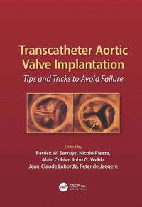 bokomslag Transcatheter Aortic Valve Implantation