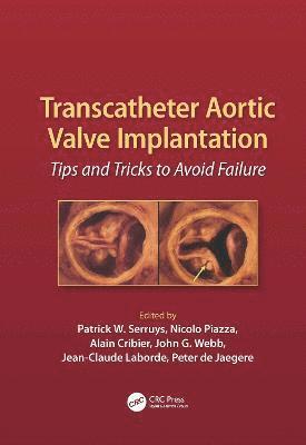 bokomslag Transcatheter Aortic Valve Implantation