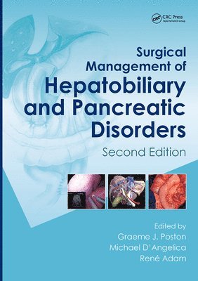 bokomslag Surgical Management of Hepatobiliary and Pancreatic Disorders