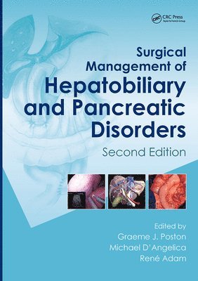Surgical Management of Hepatobiliary and Pancreatic Disorders 1