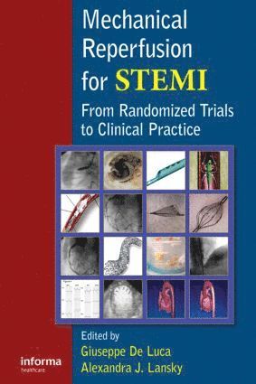 Giuseppe De Luca, Alexandra Lansky, Italy) De Luca, Giuseppe (Eastern Piedmont University, Novara, USA) Lansky, Alexandra (Columbia University Medical Center, Cardiovascular Research Foundation, New York, NY, Giuseppe de Luca - Mechanical Reperfusion for STEMI, Inbunden