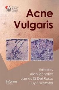 bokomslag Acne Vulgaris