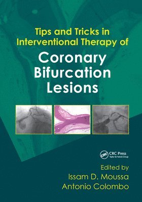 bokomslag Tips and Tricks in Interventional Therapy of Coronary Bifurcation Lesions