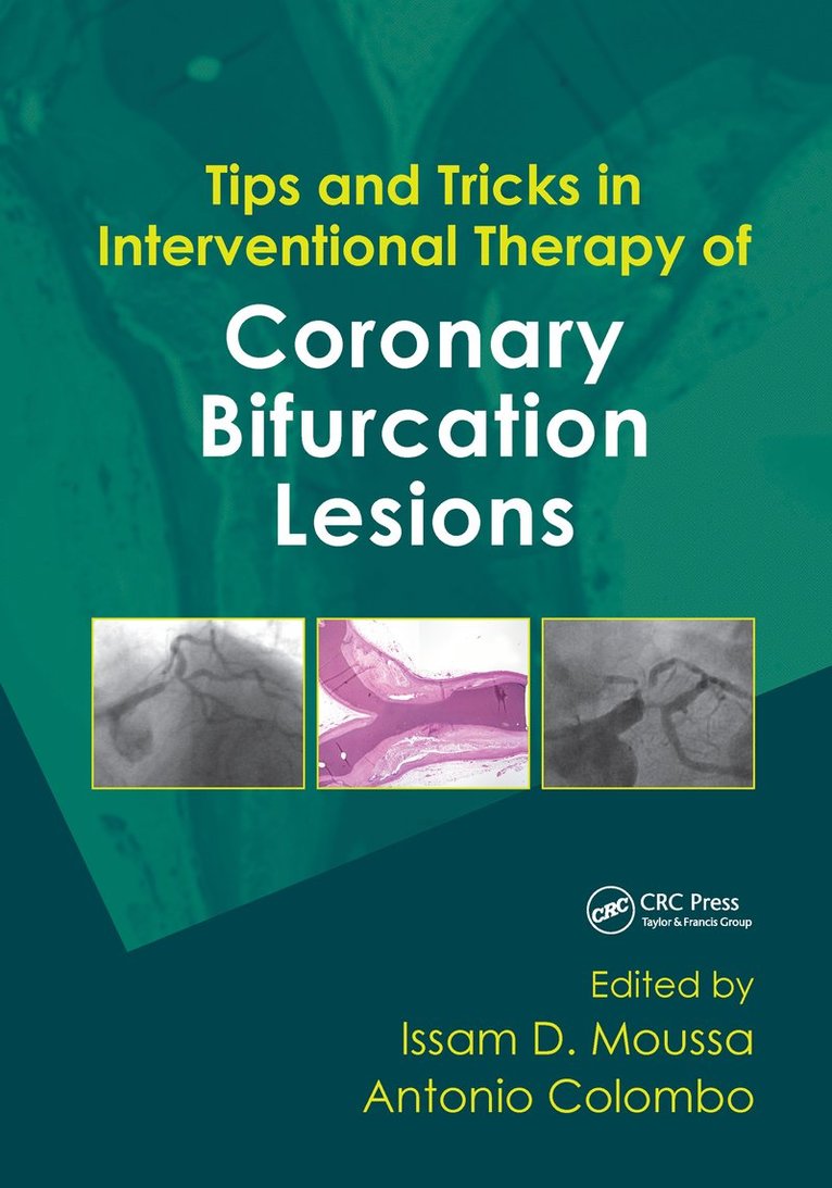 Tips and Tricks in Interventional Therapy of Coronary Bifurcation Lesions