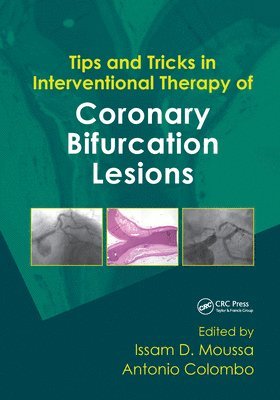 Tips and Tricks in Interventional Therapy of Coronary Bifurcation Lesions 1