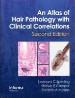 bokomslag An Atlas of Hair Pathology with Clinical Correlations