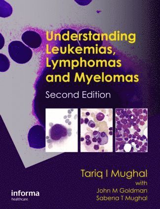 Tariq I. Mughal, UK) Mughal, Tariq I. (Tufts University Medical Center, Boston, Massachusetts, USA, Kings College NHS Foundation Trust, London, and University of Buckingham Medical School - Understanding Leukemias, Lymphomas and Myelomas, Häftad