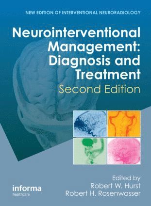 Neurointerventional Management 1