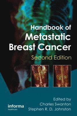 Handbook of Metastatic Breast Cancer 1