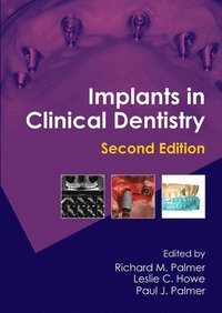 bokomslag Implants in Clinical Dentistry