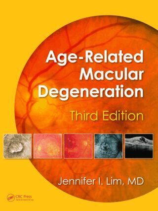Jennifer I. Lim - Age-Related Macular Degeneration, Third Edition, Inbunden