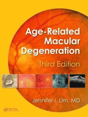 bokomslag Age-Related Macular Degeneration, Third Edition