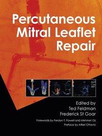 bokomslag Percutaneous Mitral Leaflet Repair