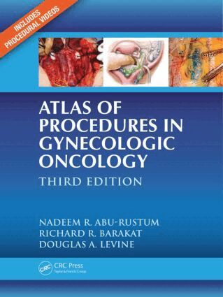 Nadeem R. Abu-Rustum, Richard R. Barakat, Douglas A. Levine, Nadeem R. Abu-Rustum - Atlas of Procedures in Gynecologic Oncology, Inbunden