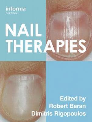 Nail Therapies 1