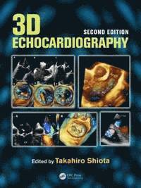 bokomslag 3D Echocardiography