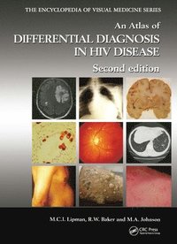 bokomslag An Atlas of Differential Diagnosis in HIV Disease