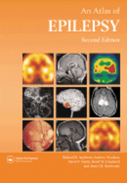 bokomslag Atlas Of Epilepsy