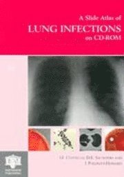 bokomslag Atlas of Lung Infections: Slide Atlas