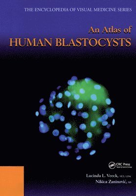 Atlas of Human Blastocysts