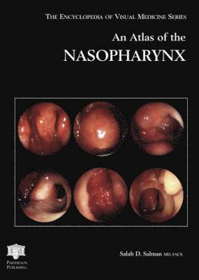 bokomslag An Atlas of the Nasopharynx