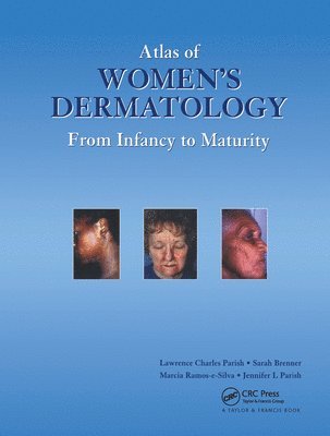 Atlas of Women's Dermatology 1