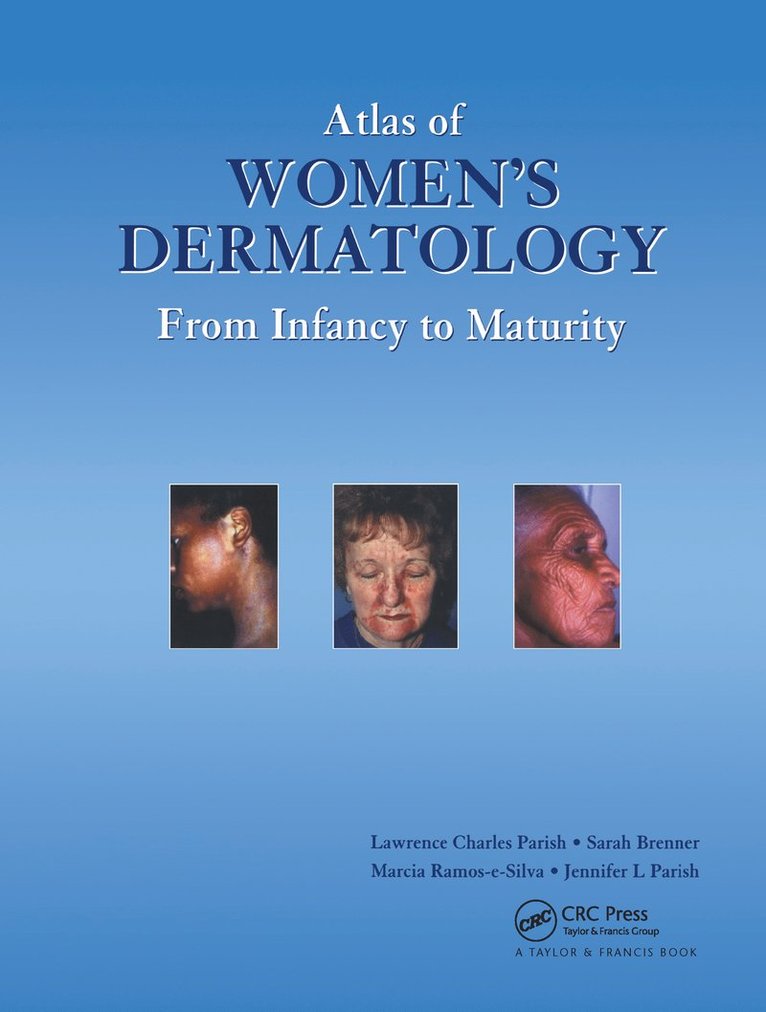 Atlas of Women's Dermatology