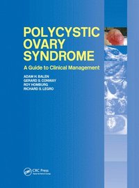 bokomslag Polycystic Ovary Syndrome