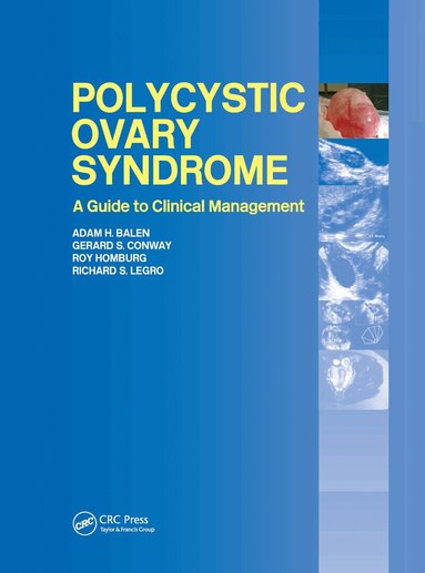 Adam H. Balen, Gerard Conway, Roy Homburg, Richard Legro - Polycystic Ovary Syndrome, Inbunden