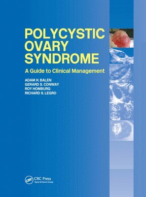 Polycystic Ovary Syndrome 1