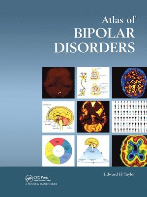 bokomslag Atlas of Bipolar Disorders