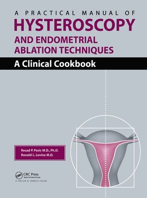A Practical Manual of Hysteroscopy and Endometrial Ablation Techniques 1
