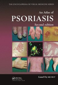 bokomslag An Atlas of Psoriasis, Second Edition