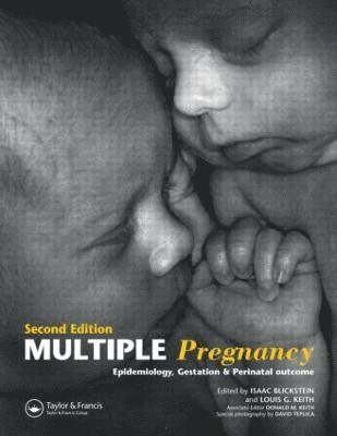 Multiple Pregnancy 1