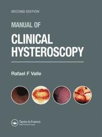 bokomslag Manual of Clinical Hysteroscopy, Second Edition